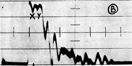 Gewebsanalysen_Graph_Brust_Krebs.jpg